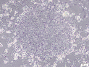 asclestem 3.png