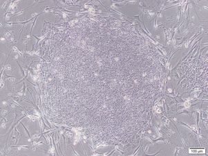 asclestem 4.png