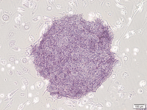 asclestem 5.png