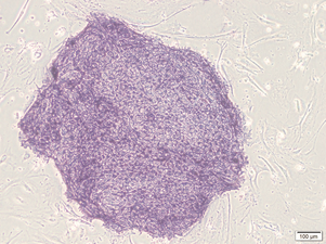 asclestem 6.png